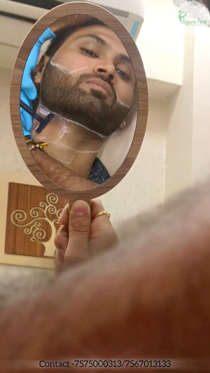 Precision Beard Shaping & Laser Hair Removal
